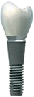 Crown on a dental implant