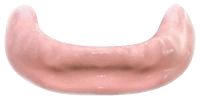 Replacing all teeth